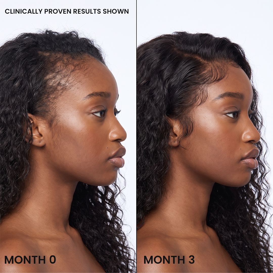 Korea's #1 Hair Growth Serum new site