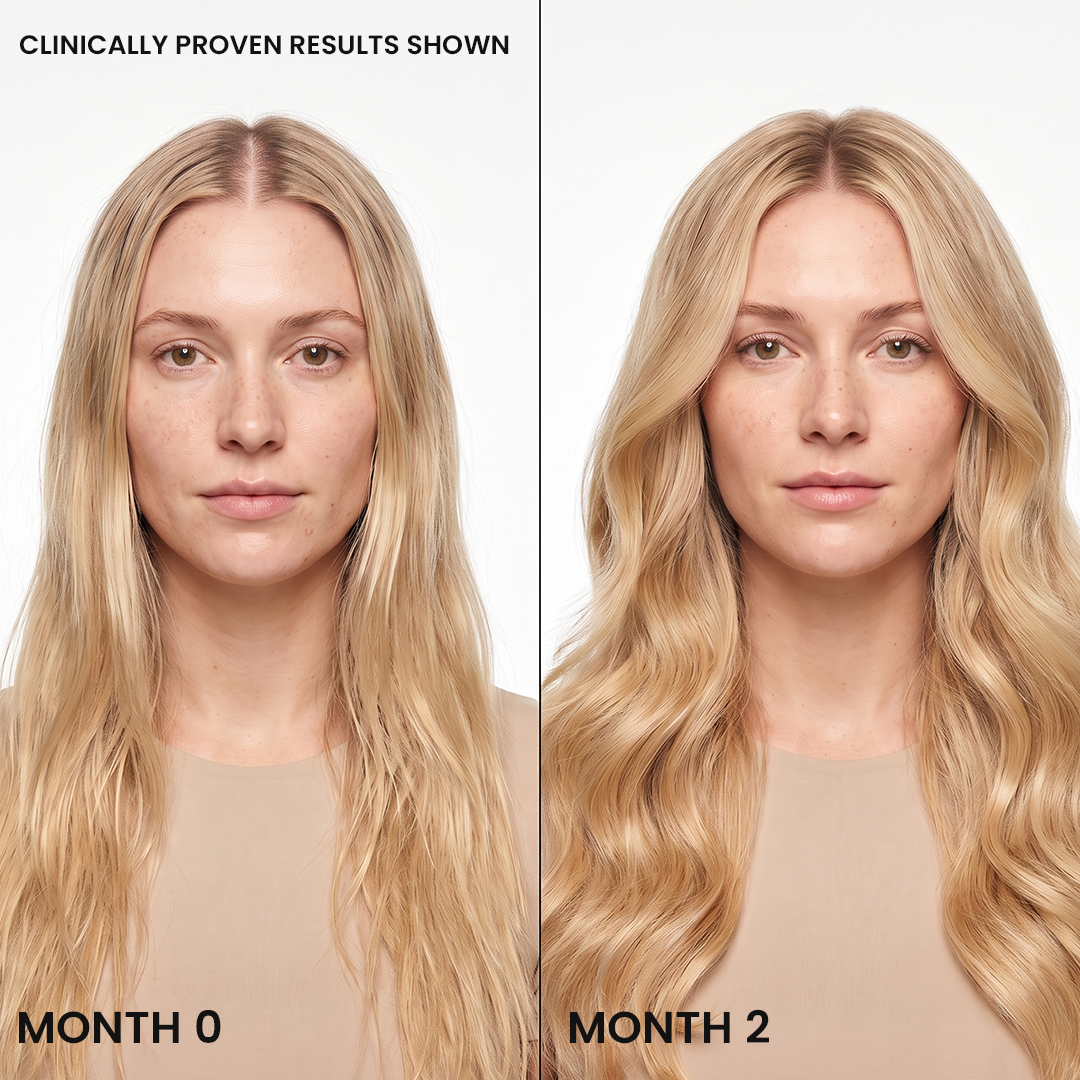 Korea's #1 Hair Growth Serum new site