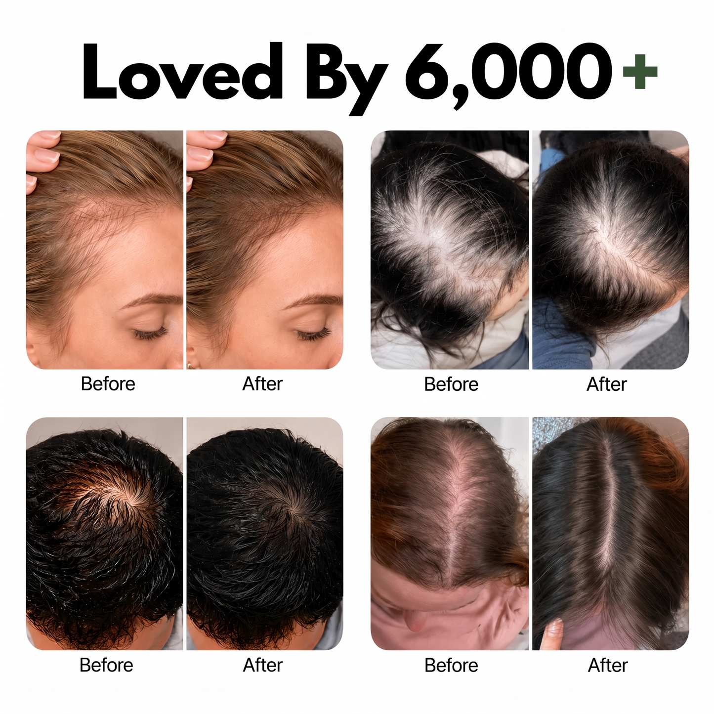 Korea’s #1 Hair Growth Shampoo