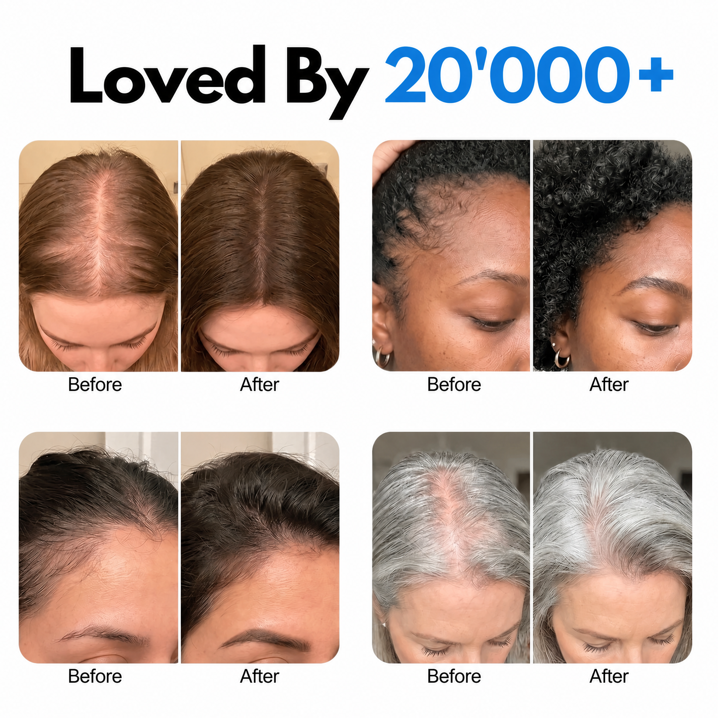 Korea's #1 Hair Growth Serum new site