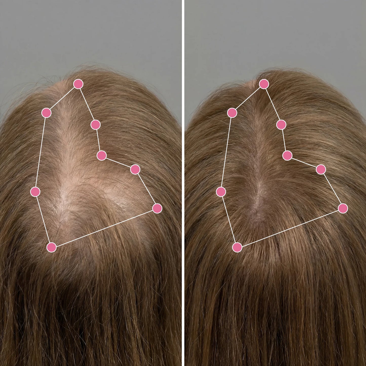 Korean Scalp Revival Bar