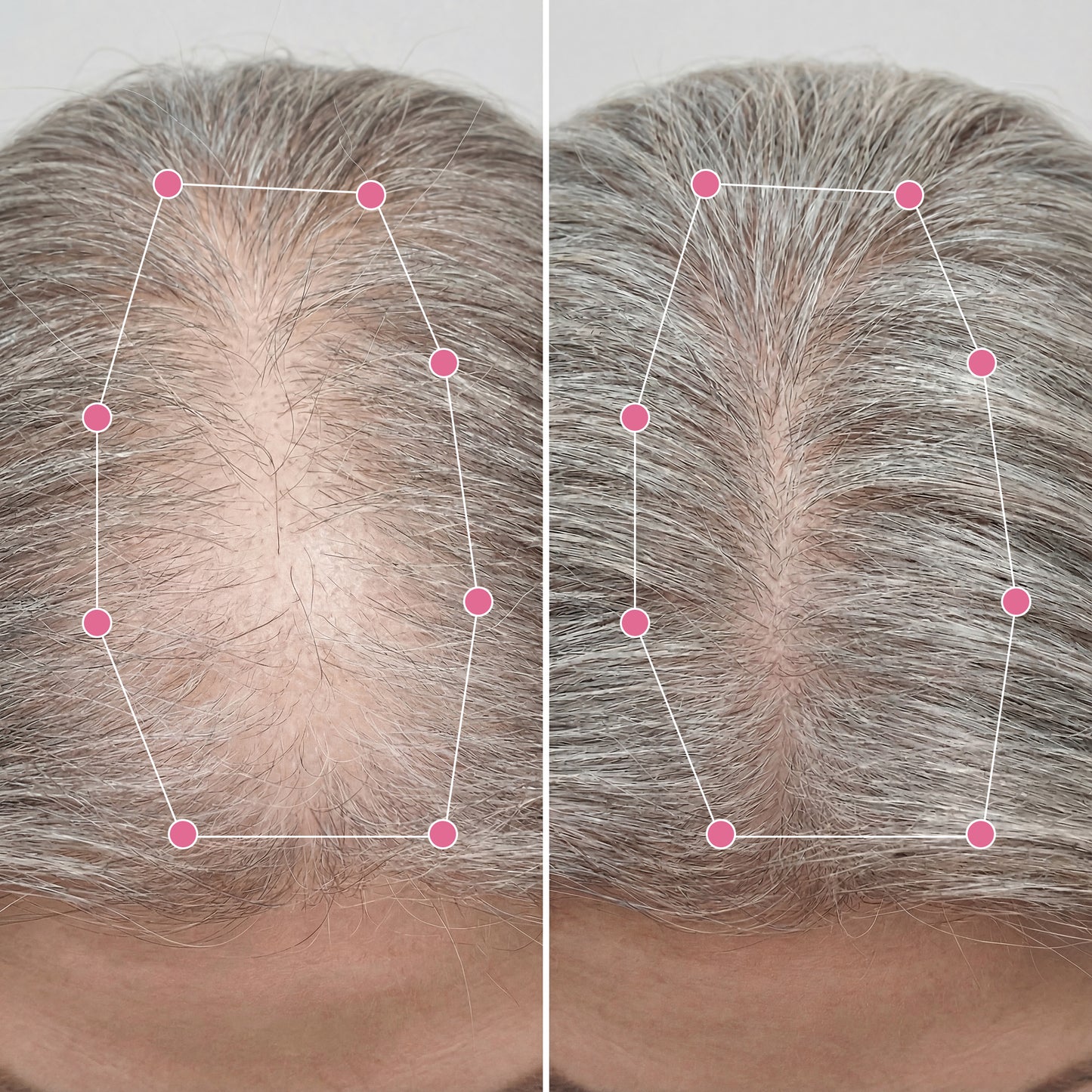 Korean Scalp Revival Bar